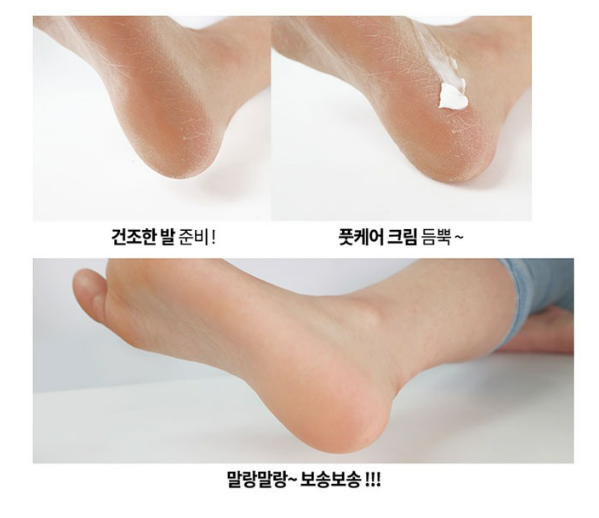 واحد - كريم لتشقق الاقدام والعناية المركزة بكعب القدم | (ONE) Dragon Foot Peeling Foot Care Cream
